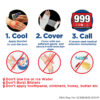 Sterile Burn Dressing 20cm x 20cm