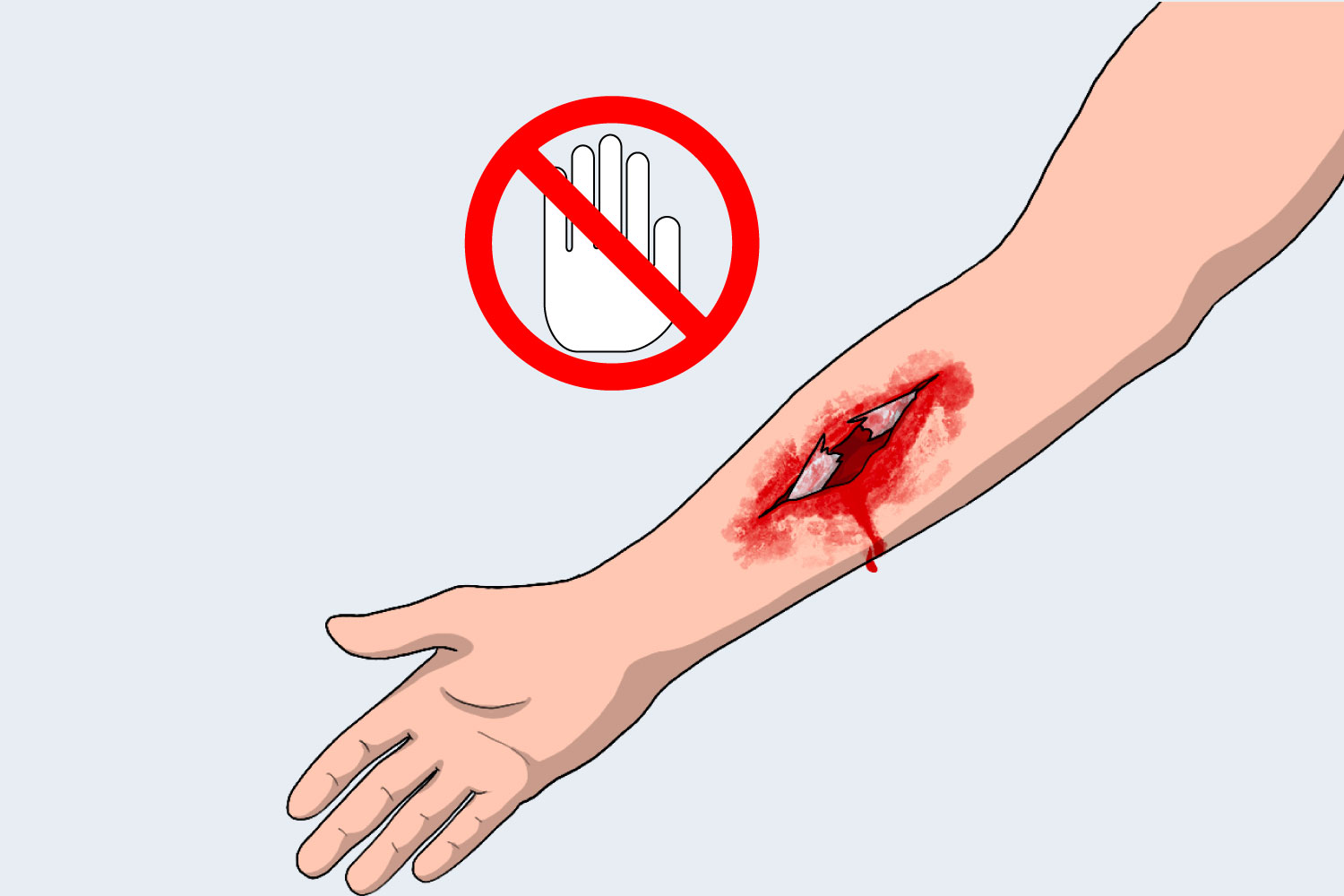 First Aid For Fractures